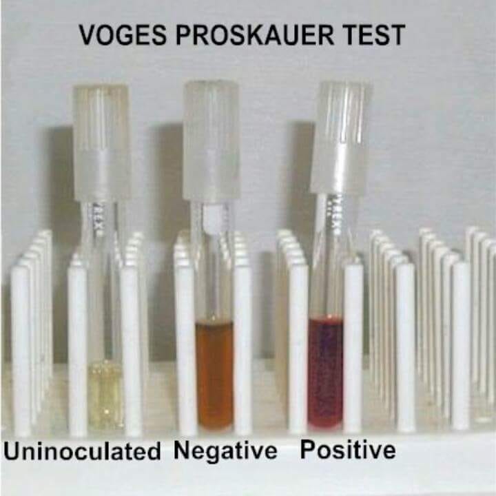 Khaled - Voges–Proskauer /ˈfoʊɡəs ˈprɒskaʊ.ər/ or VP is a test used to ...