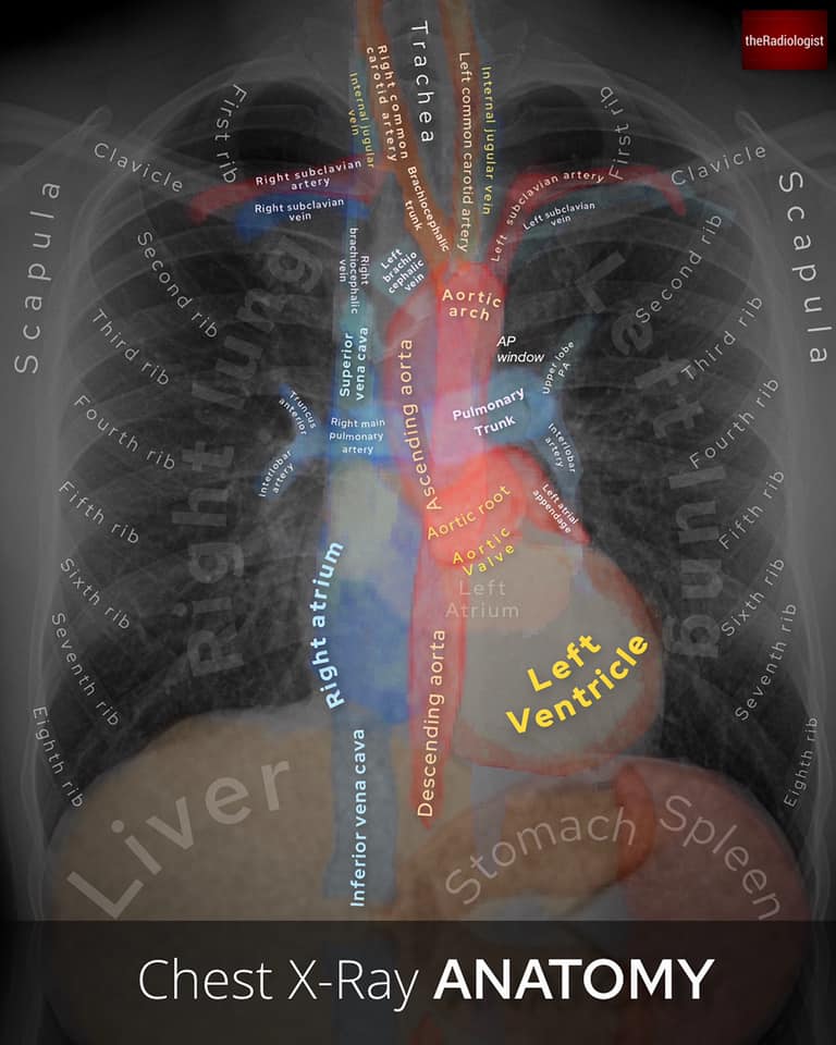 The Radiologist - 💀WHEN CHEST X-RAYS COME ALIVE💀⁣ ⁣ 👨🏽‍💻This is a Chest ...
