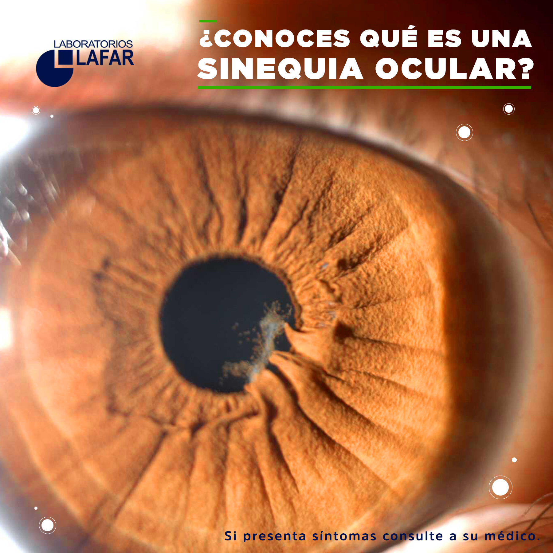 La sinequia ocular es... - Laboratorios LAFAR Internacional | Facebook