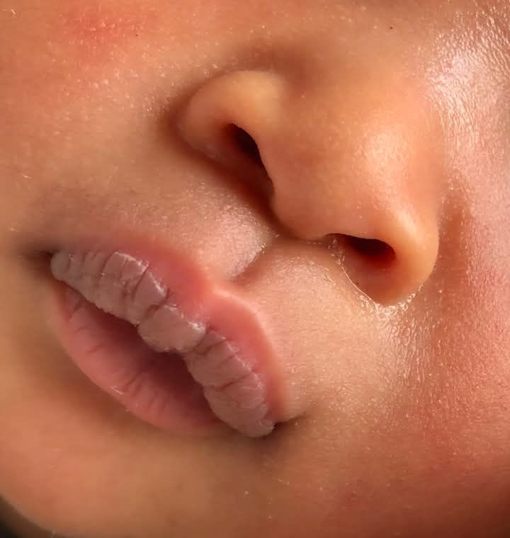 Why is my newborn's lips chapped?