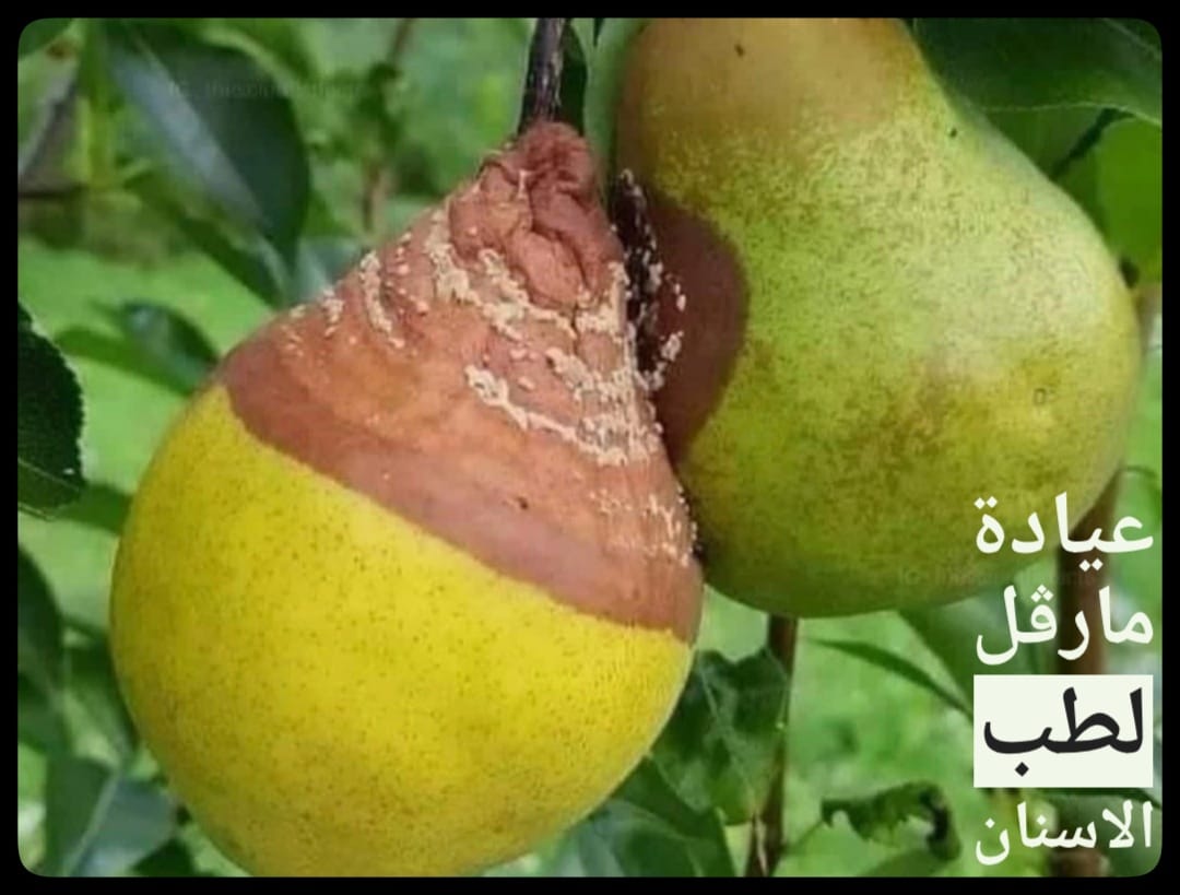 إذا ردنا نوصف التسوس 🤔 شوفو... - عيادة مارفل لطب الاسنان | Facebook