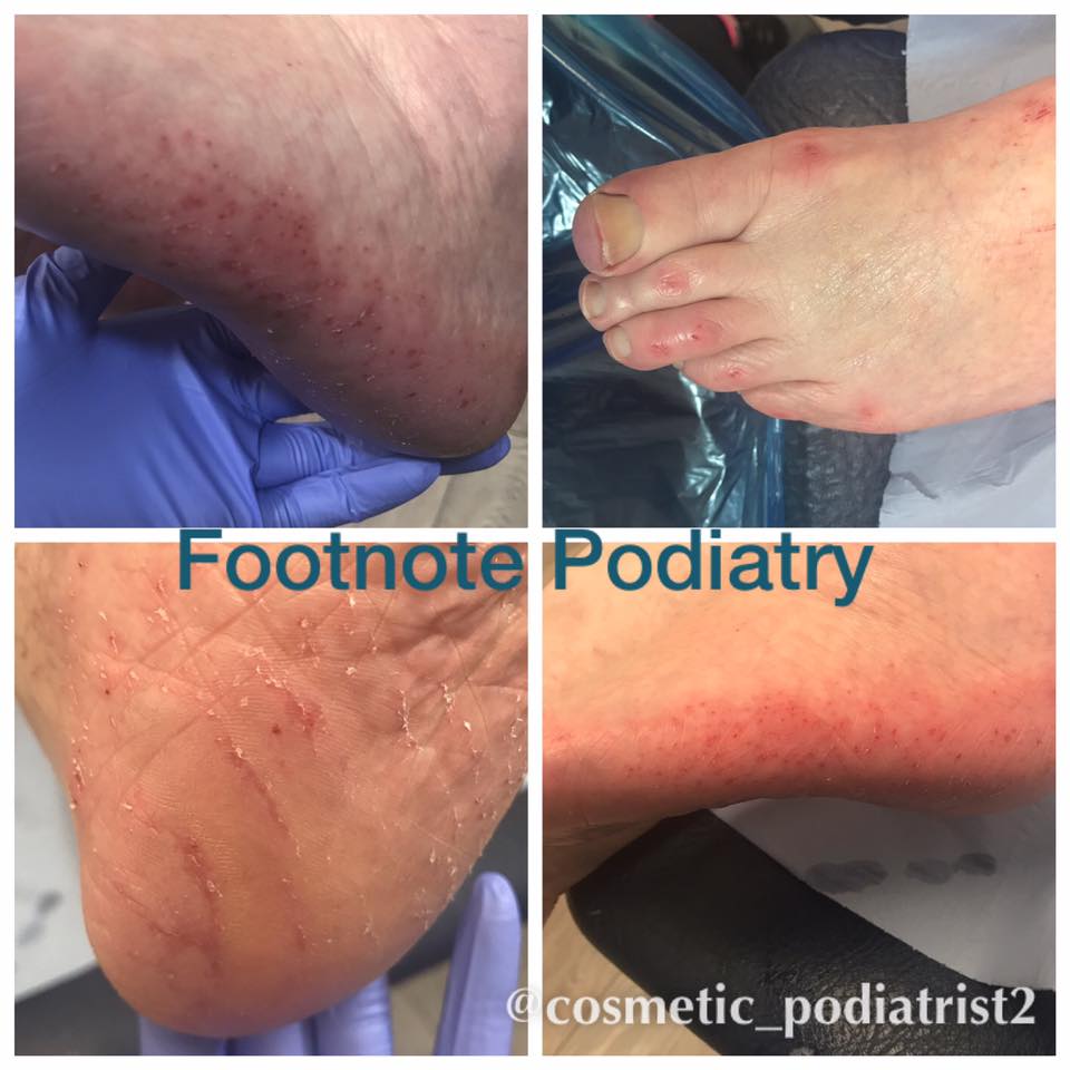 Footnote Podiatry | Preston
