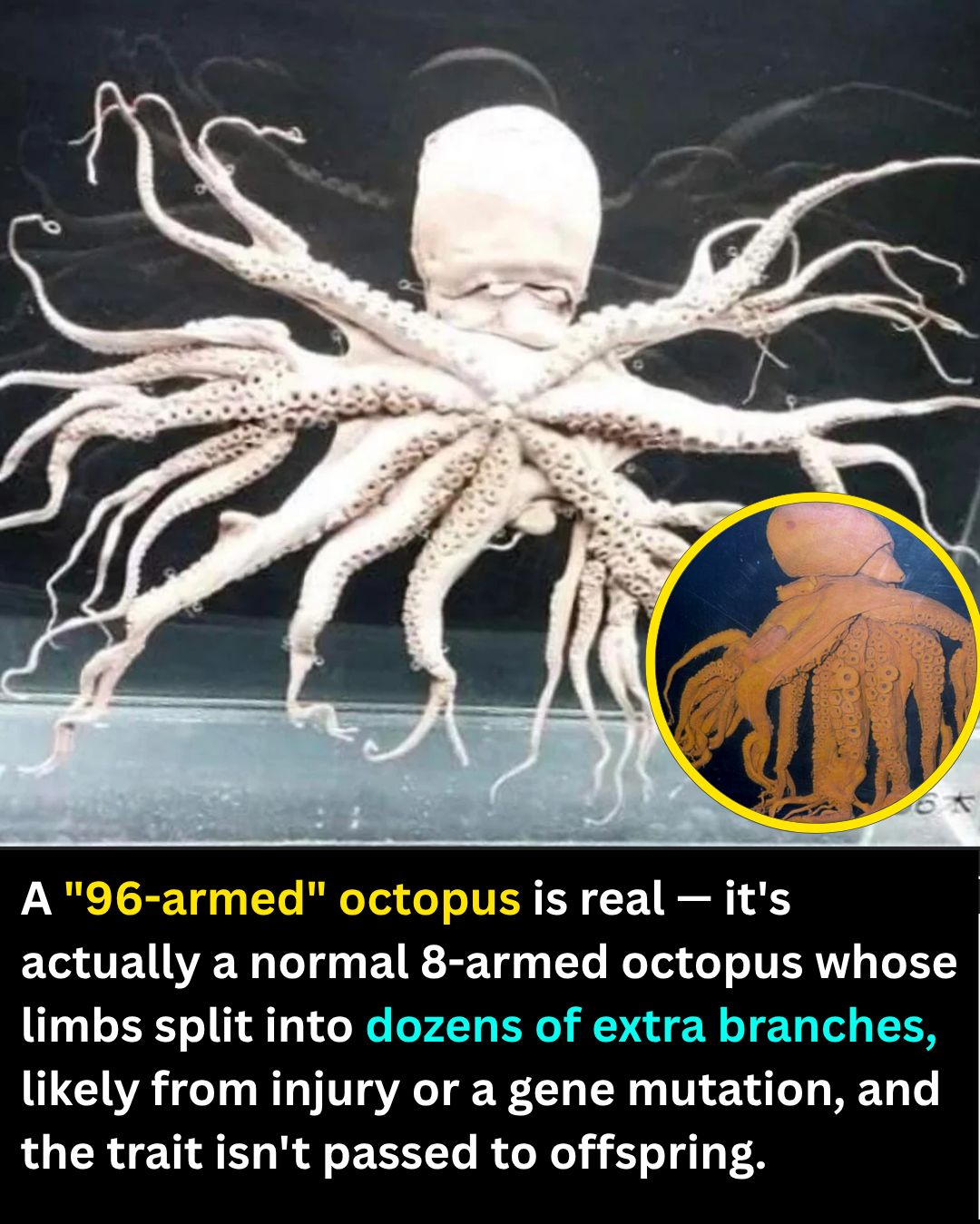 Octopus with 96 tentacles found in Japan in 1998