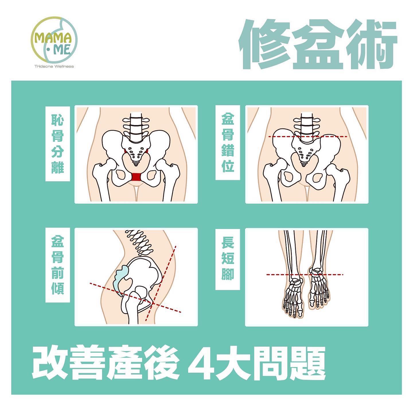 【為何要修復盆骨？】 產後/... - MaMa Me 袓傳紮肚 產前後護理專家 | Facebook