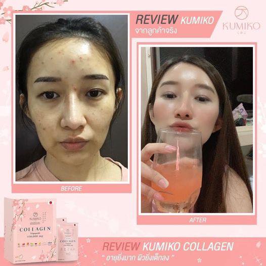 Kumiko Collagen Premium - Boîte De 10 Sachets - Éclat, Blanchiment, Anti-âge - Saveur Fruit