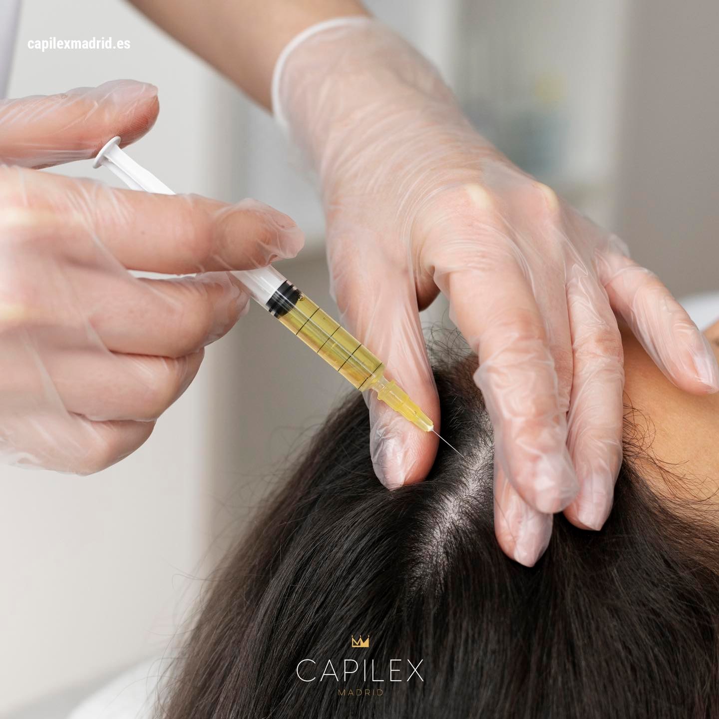Capilex Madrid - ️ Son muchas las ventajas y beneficios... | Facebook