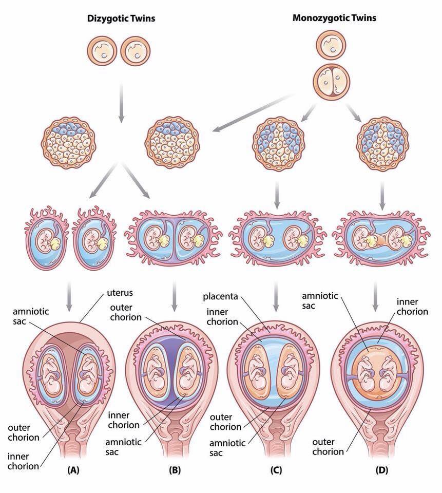 Monozygotic