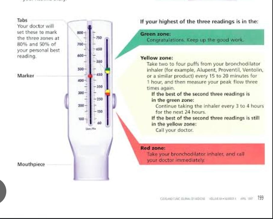 EXCEL HEALTH CONCEPT | The 3 peak flow zones are noted by color and ...