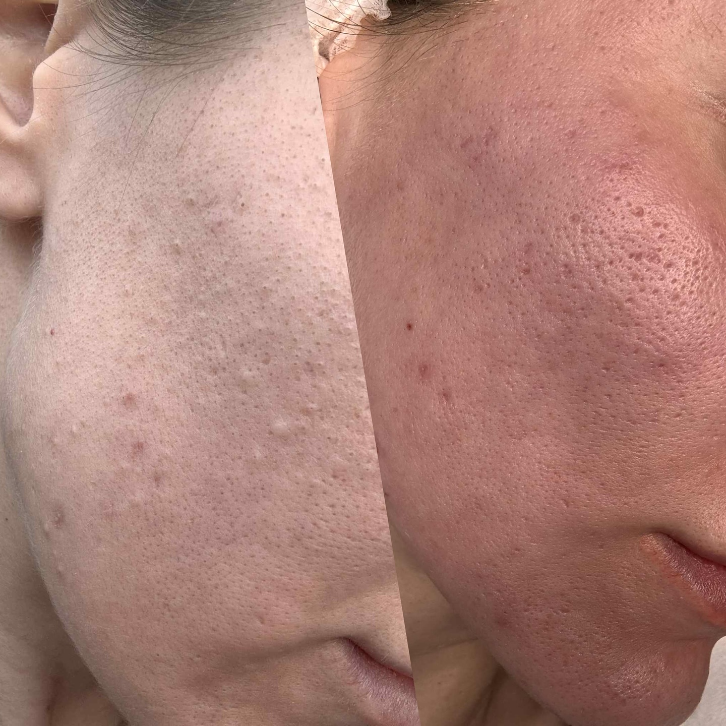 Cosmetolog Ana Racu