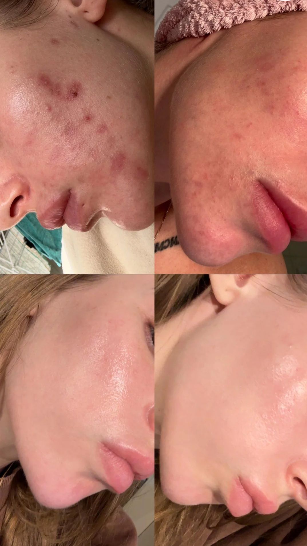 Does ghk cu serum really work?