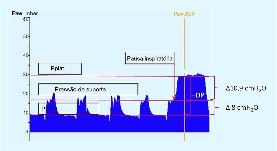 Ventilação Mecânica - curso Prof. Ângelo Roncalli - É possível medir a ...