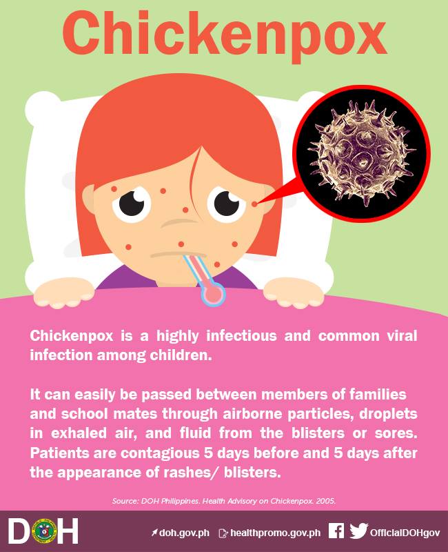 What is Chickenpox... - Department of Health (Philippines) | Facebook