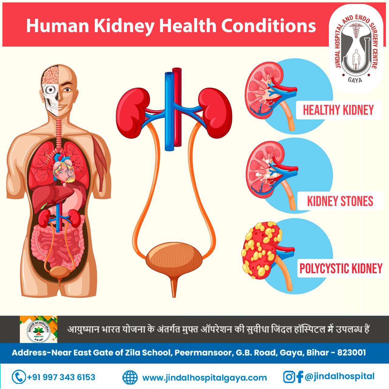 Jindal Hospital And Endo Surgery Centre - 👉 𝐒𝐮𝐫𝐠𝐞𝐫𝐲 𝐃𝐨𝐧𝐞 𝐇𝐞𝐫𝐞 𝐅𝐨𝐫 ...