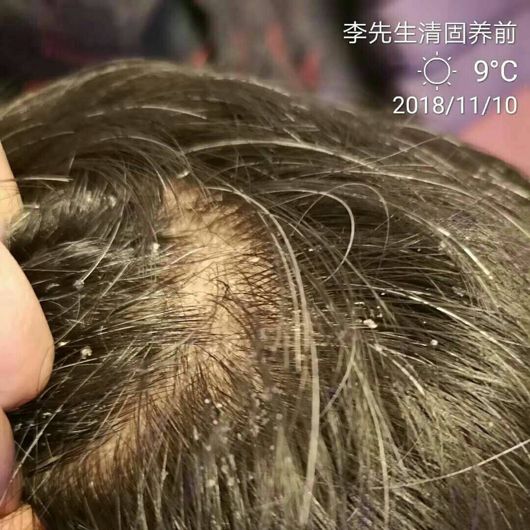 M.Signatureღ經銷商 · 高級批發 - 经皮毒的危害经皮毒可危害女性子宫和男性睾丸 严重可摧毁神经系统化学物质通过皮肤进入身体内部 ...