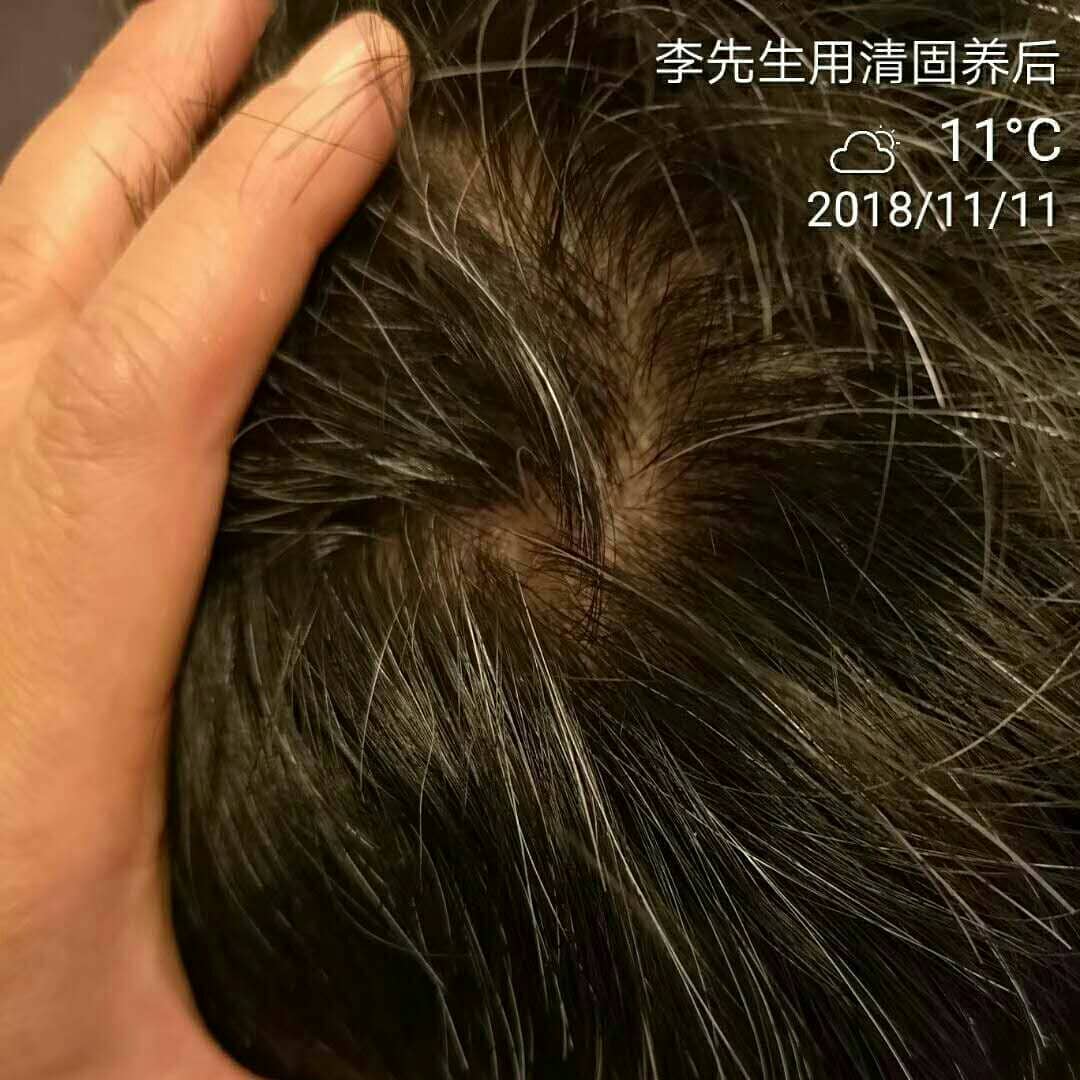 M.Signatureღ經銷商 · 高級批發 - 经皮毒的危害经皮毒可危害女性子宫和男性睾丸 严重可摧毁神经系统化学物质通过皮肤进入身体内部 ...