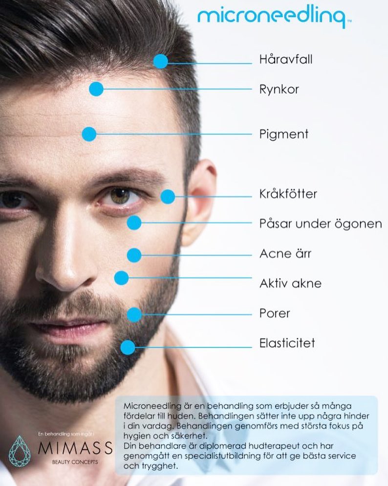 ABC Hudvård - Microneedling är utvecklat för att stimulera nya ...