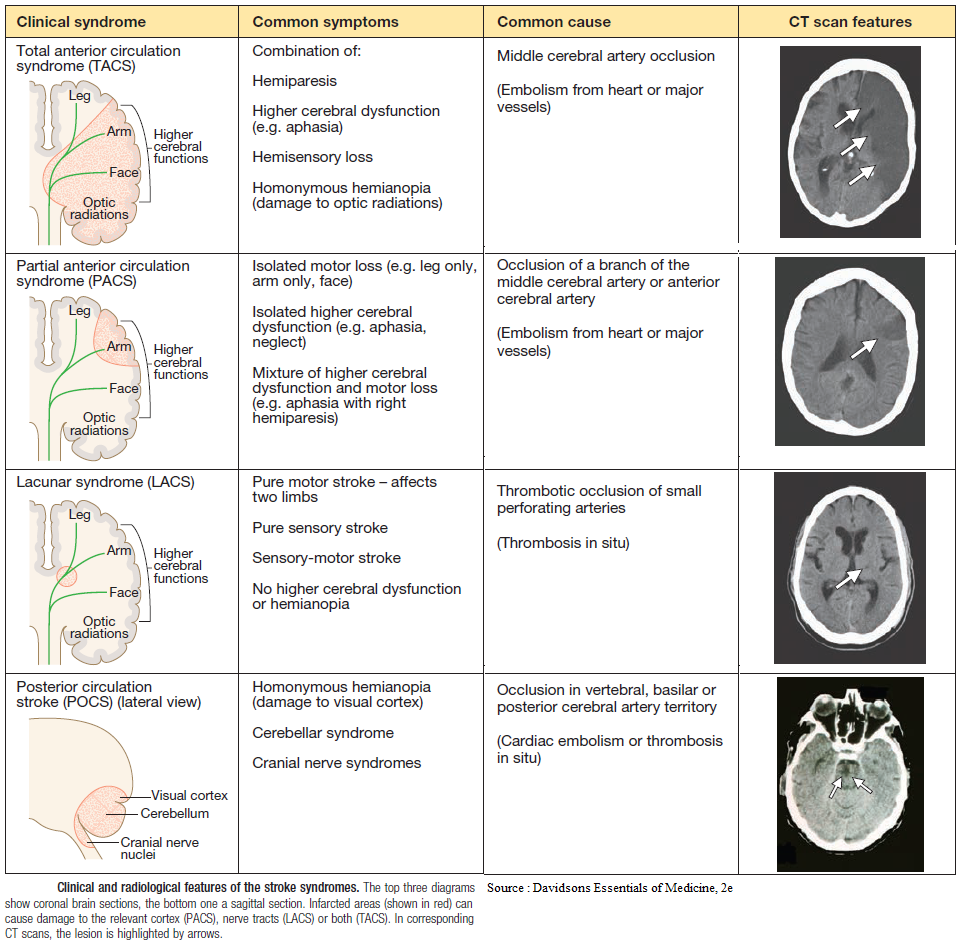 🔶 Clinical and Radiological Features... - Manual of Medicine | Facebook