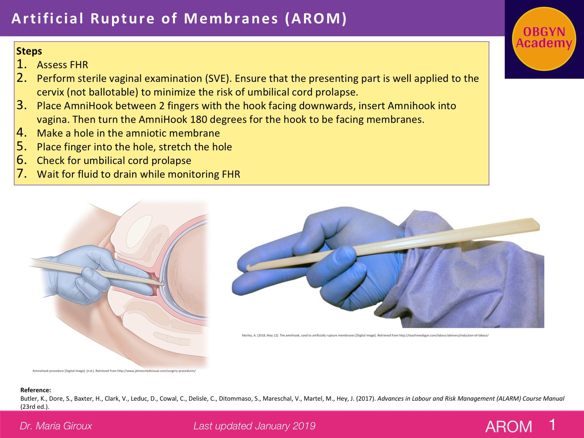 : Artificial rupture... - Nursing Notes NLE NCLEX HAAD Etc | Facebook