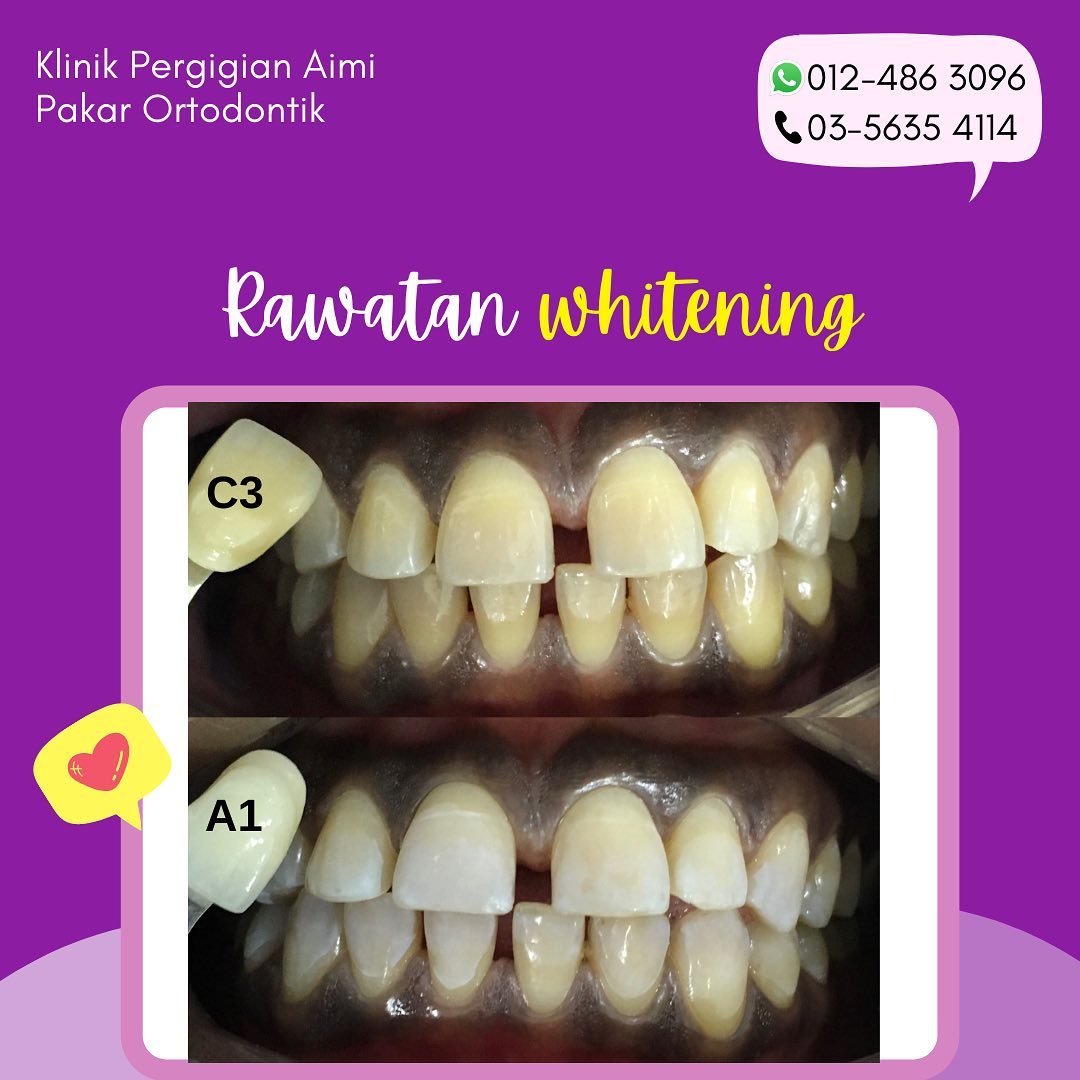 Klinik Pergigian Aimi 홈 Facebook