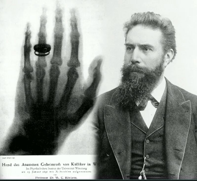 Gruppo TSRM Giovani - 22 dicembre 1895 la prima radiografia medica ...