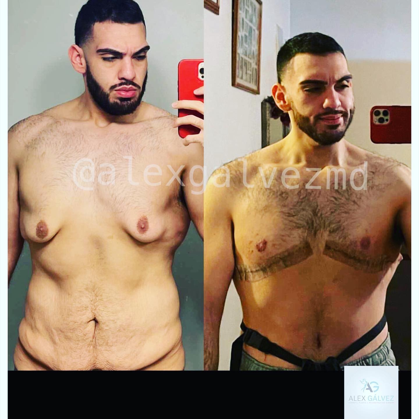 Alex Gálvez MD | Tijuana