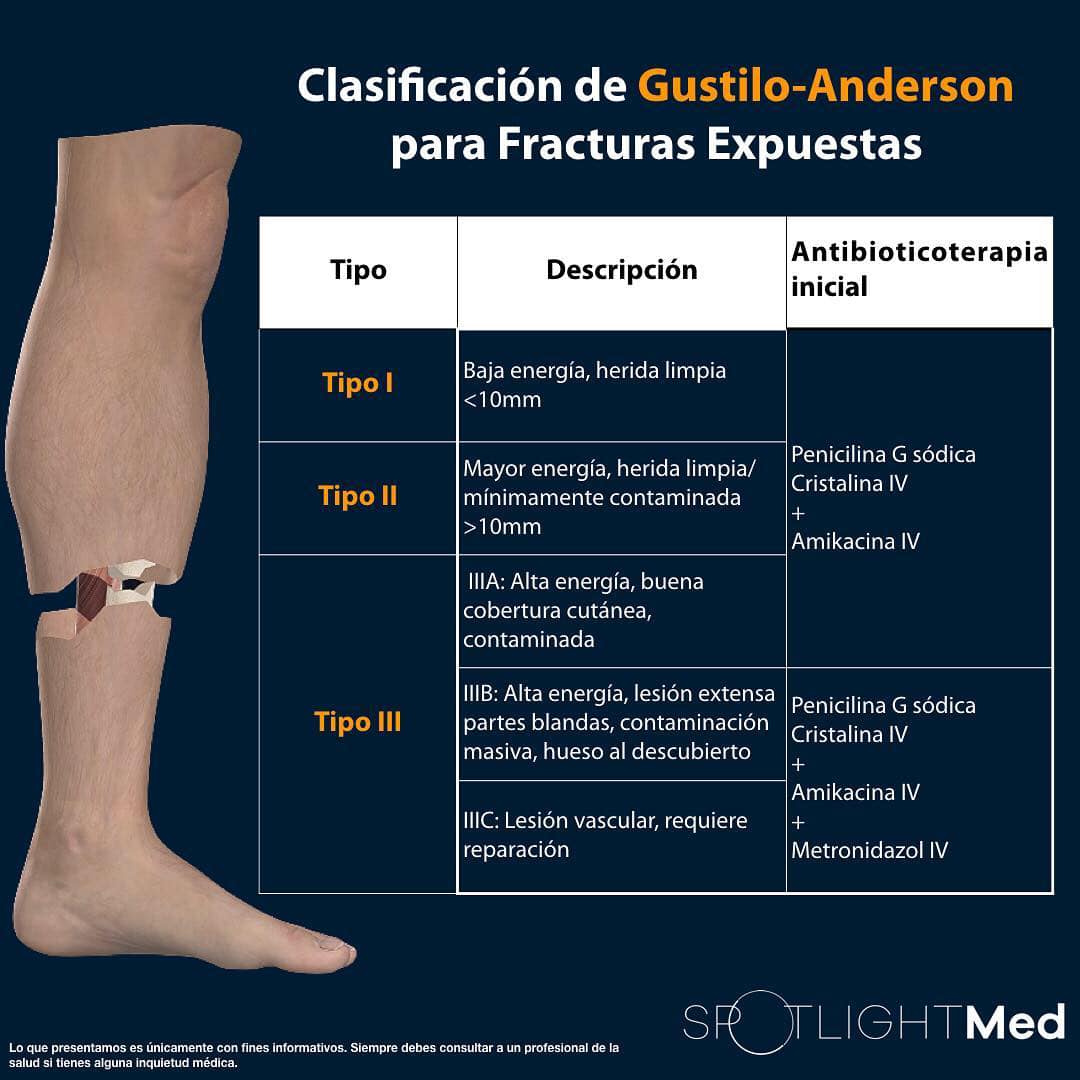 SpotlightMed - Clasificación de Gustilo-Anderson para... | Facebook