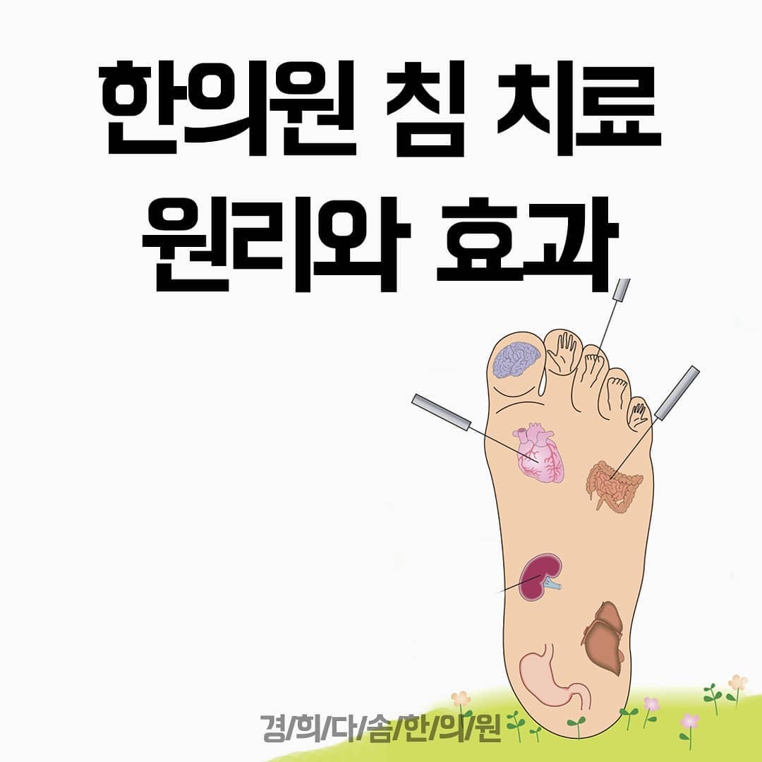 경희다솜한의원 - 침 치료의 원리가 궁금하셨던 분들은 주목! 🙏 ⠀ 어떤 원리에 의해 침 치료와 약침... | Facebook