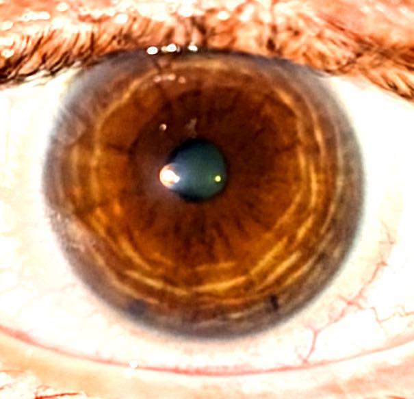 Opinions on kaotica eyeball ?
