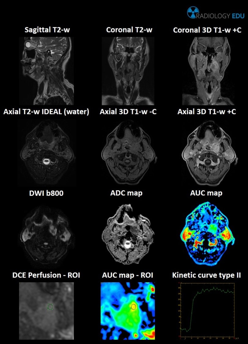 Radiology EDU - Multiparametric MR Imaging of the head and... | Facebook