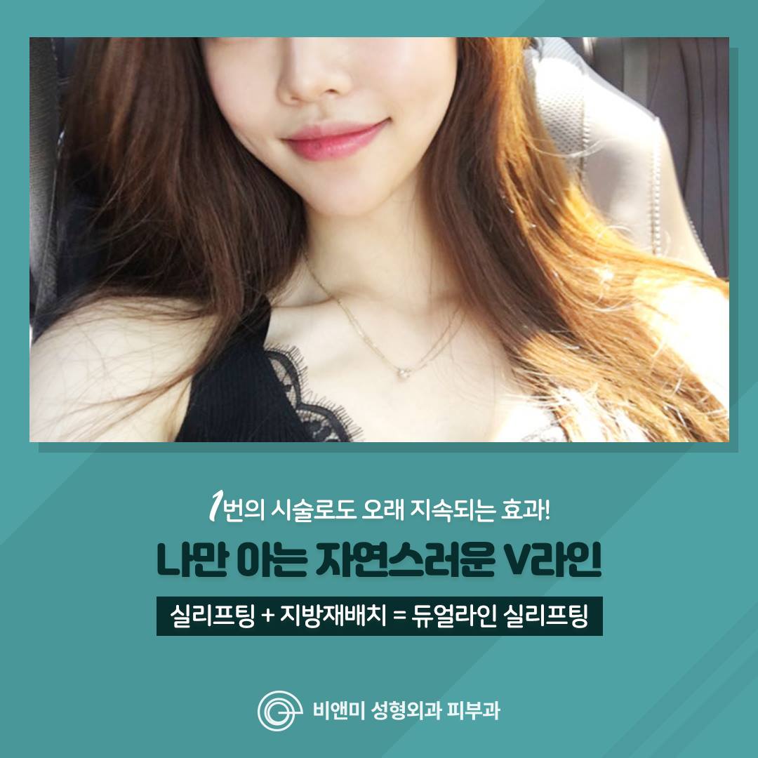 비앤미 성형 - 그녀가 선택한 V라인! 💜💛💚 ((리프팅과 지방배치를 한번에)) 🌹비앤미 듀얼라인...