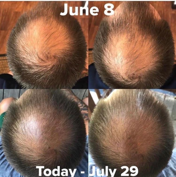 GHK-Cu copper peptide for hair growth