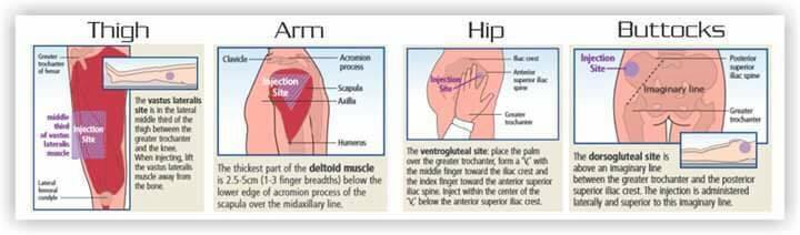 Im Injection Technique Nasco Intramuscular Injection Model | AED