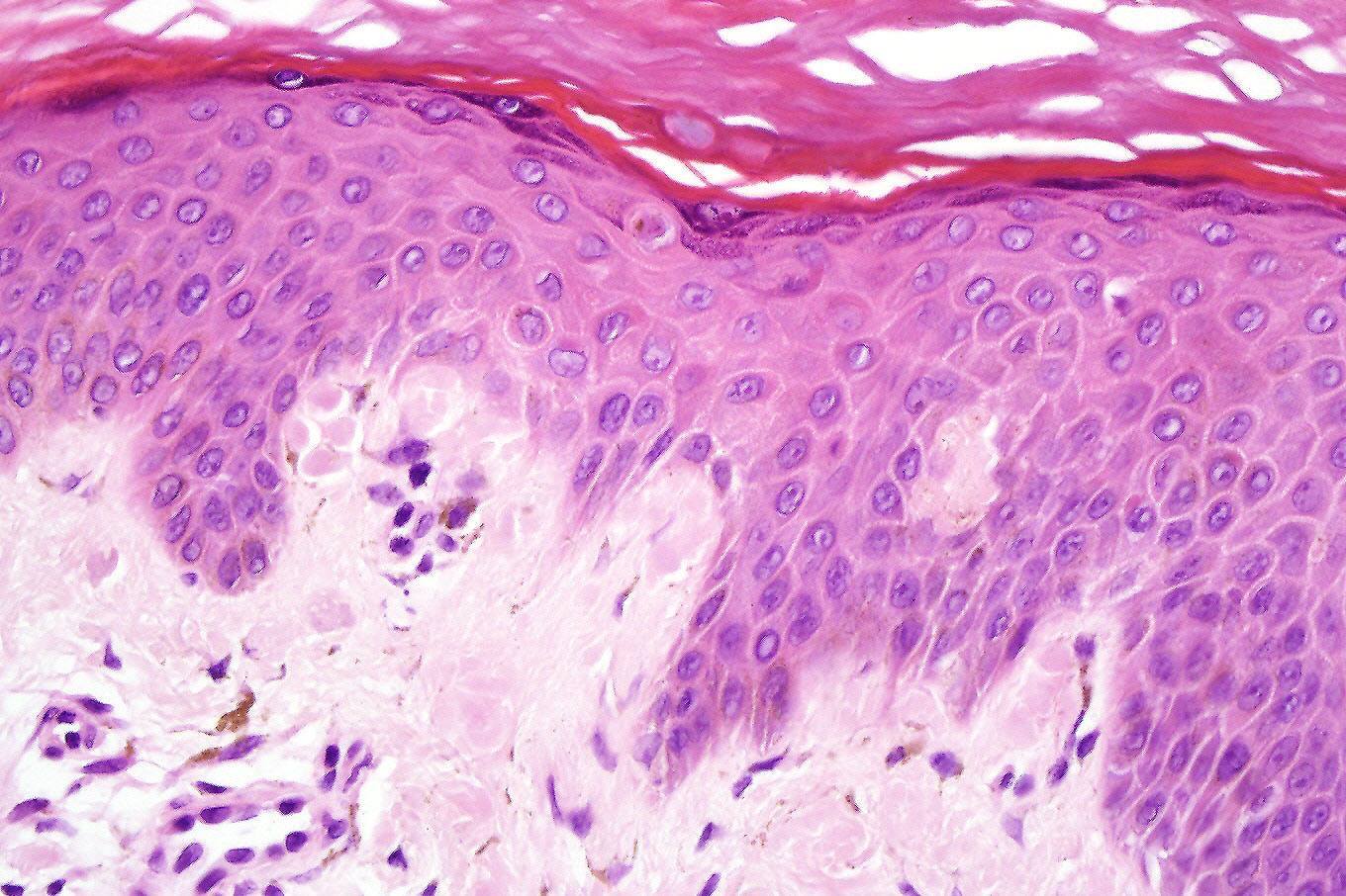 International Society of Dermatopathology