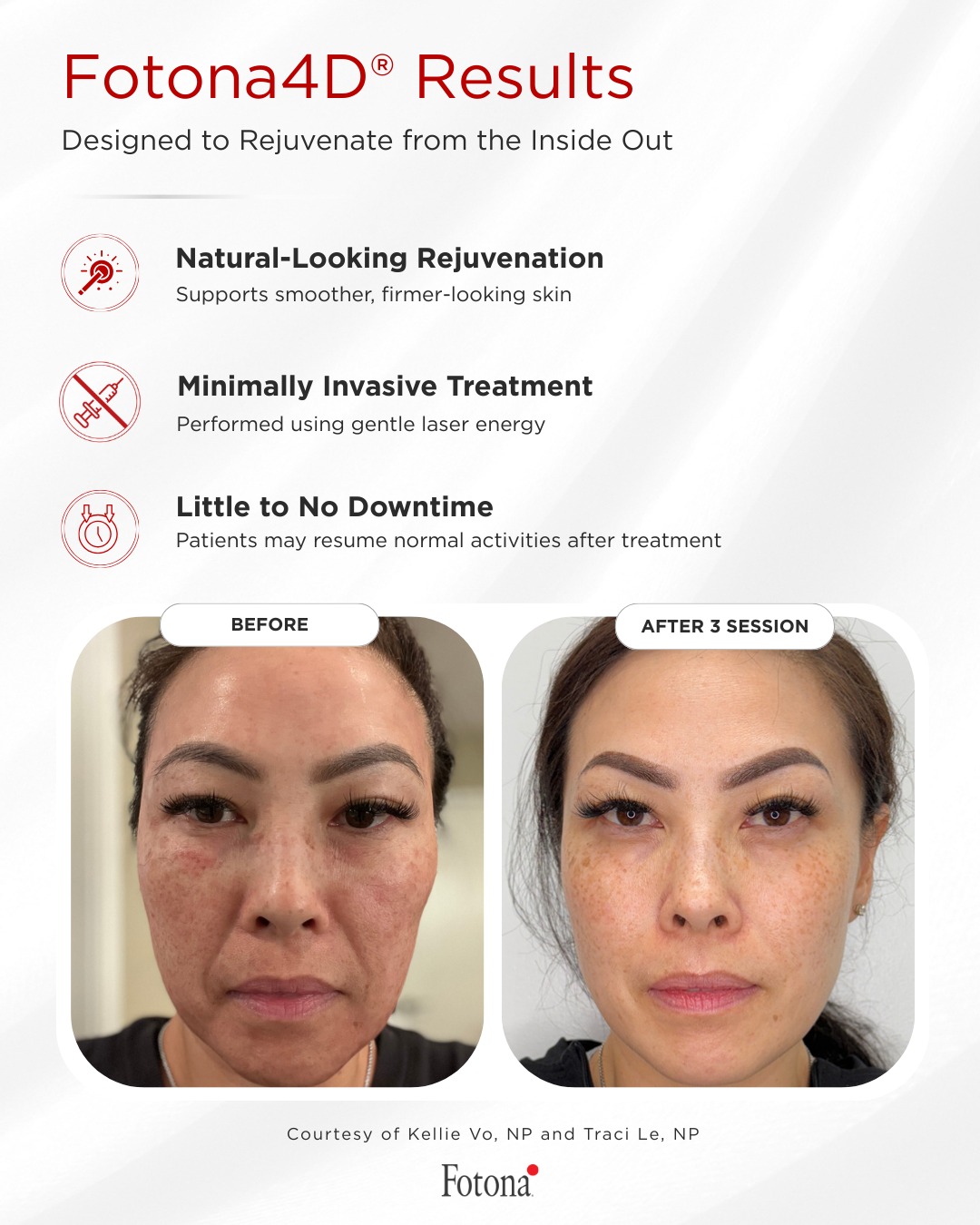 glutathione eye drops eye color change scientific evidence That Color? Experts Sound the Alarm Patient demand for minimally invasive
