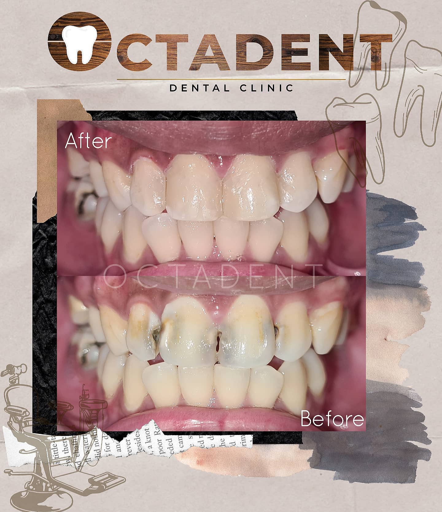 Our teeth plays a major... - Octadent Dental Clinic - Bacolod