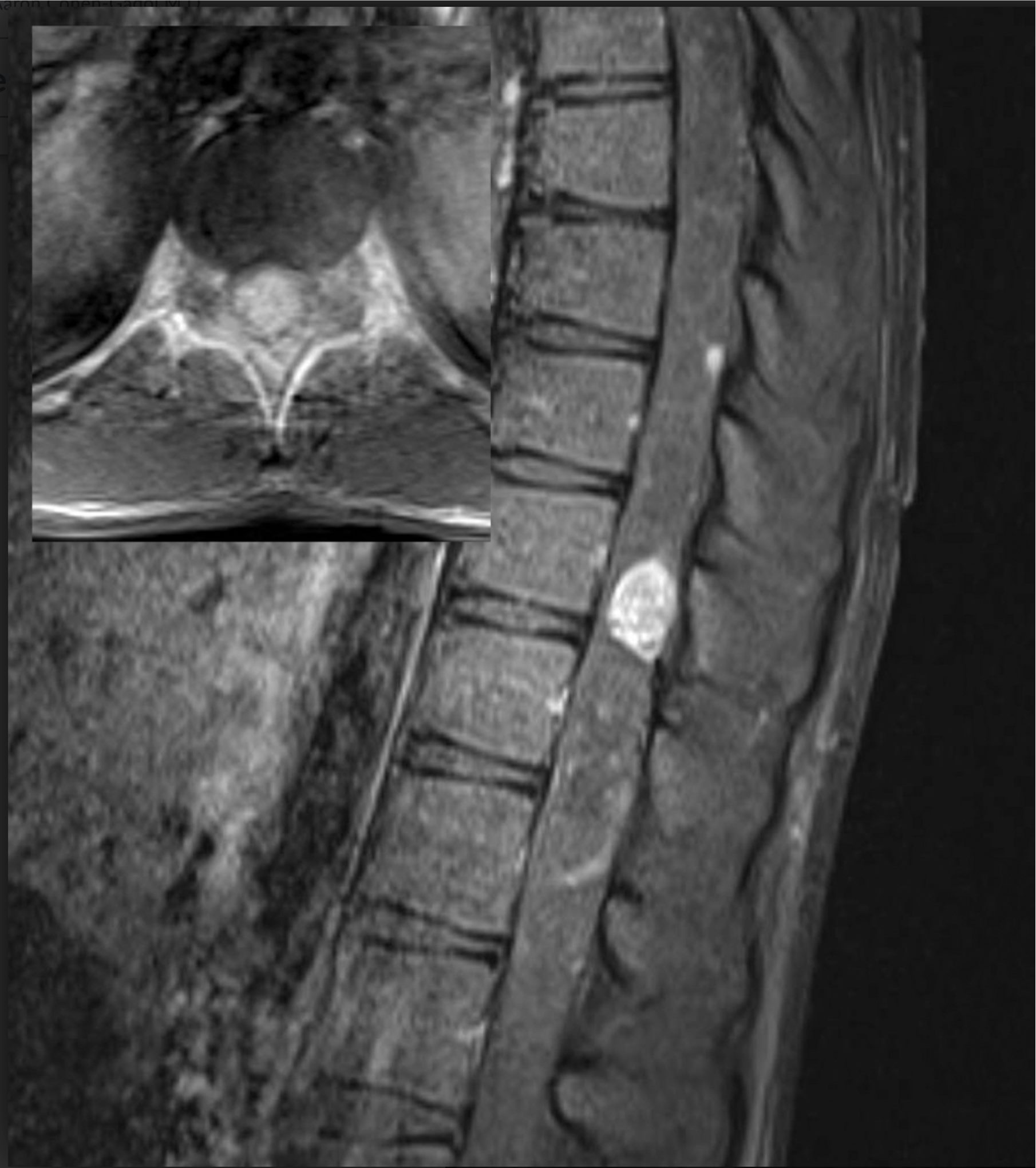 Here is the answer to the most... - The Neurosurgical Atlas