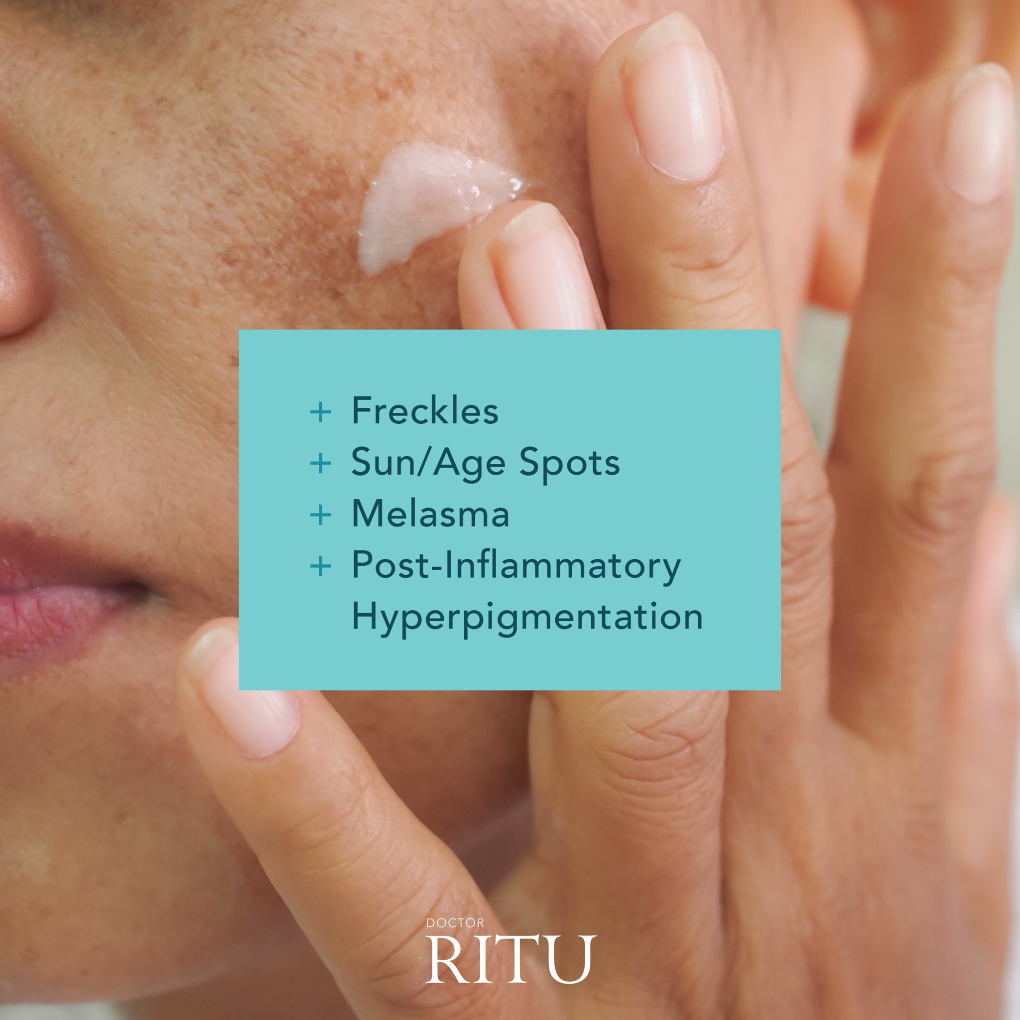 Platinum Dermatology Been Relying On Supermarket Skincare Products To Solve Your Pigmentation Problems While They Offer Promises Of Fading Sun Age Spots And Bringing Youth Back To Your Skin They