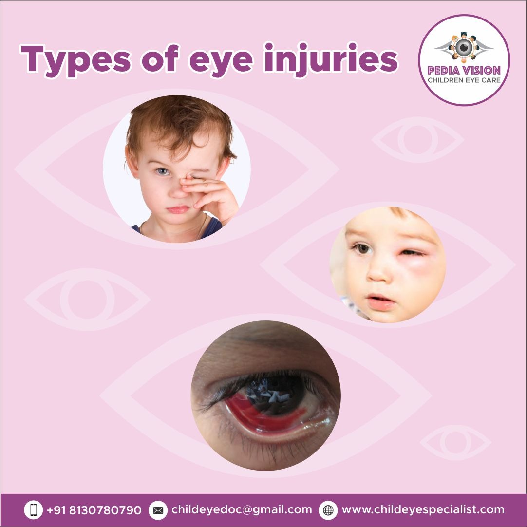 Child - There are many different types of eye injuries that require ...