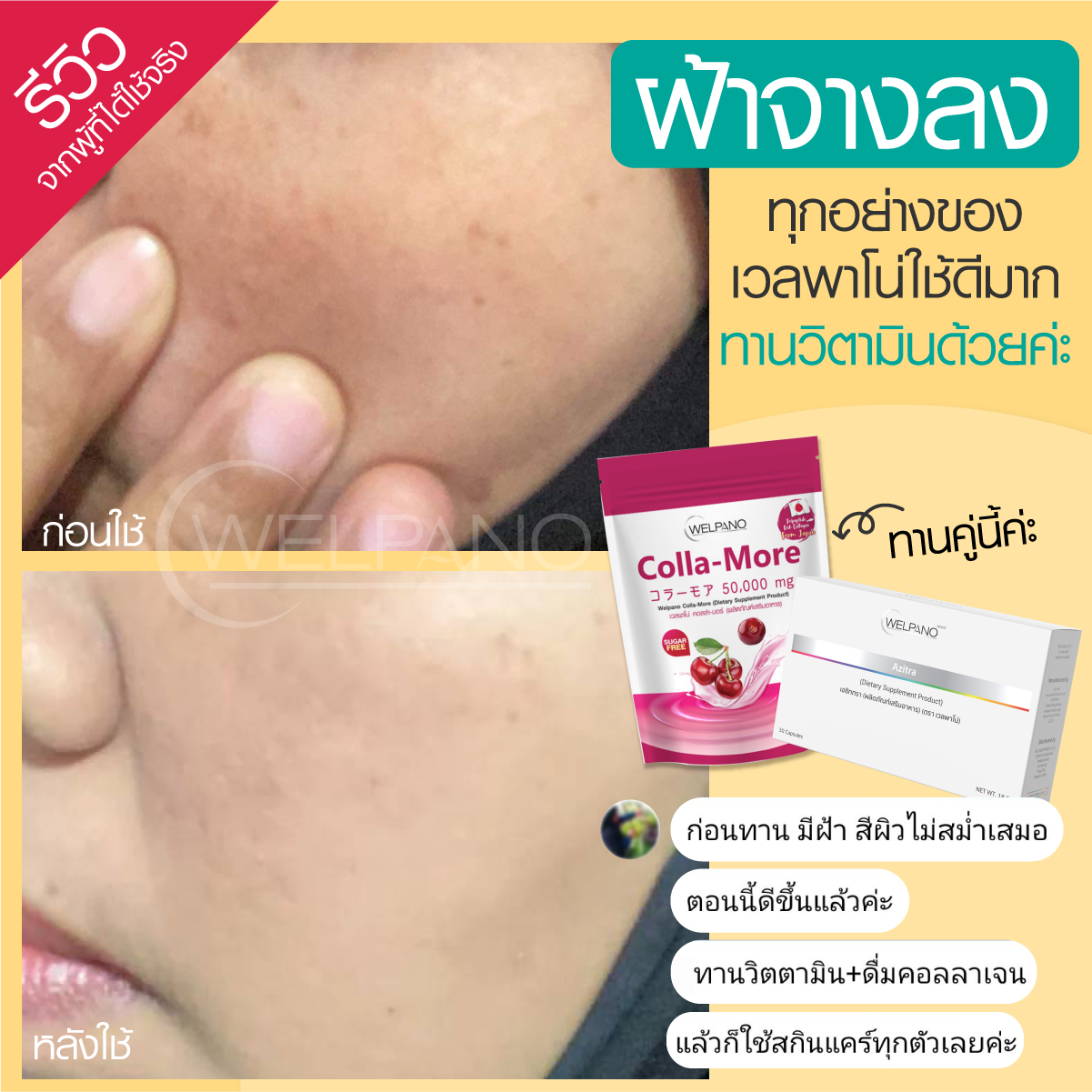 ส่งภาพมารีวิวค่ะ... - Welpano Cosmetics : เวชสำอางโดยเภสัชกร