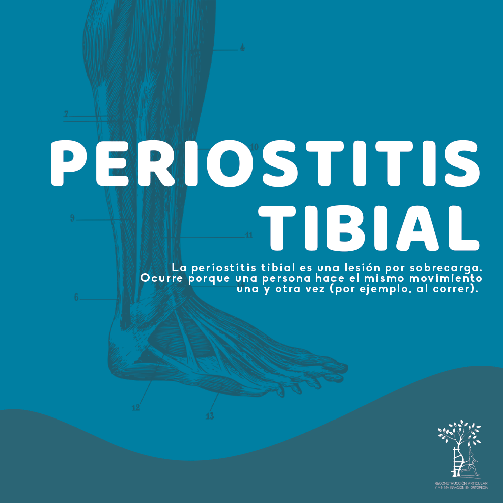 Dr Luis Felipe Rangel / Ortopedia - ¿Qué es la periostitis tibial? ⚡️ ...