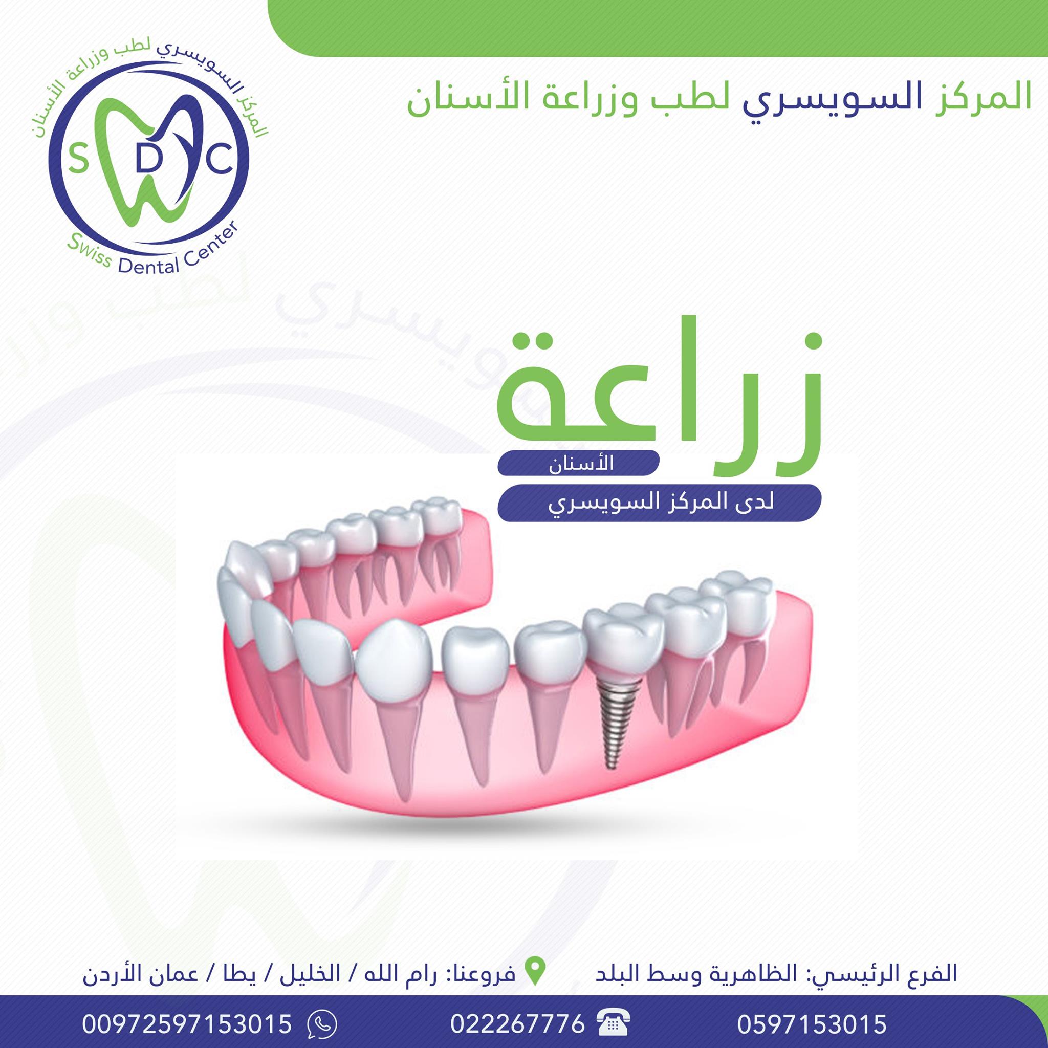زراعة الأسنان لدى المركز السويسري لطب وزراعة الأسنان Facebook