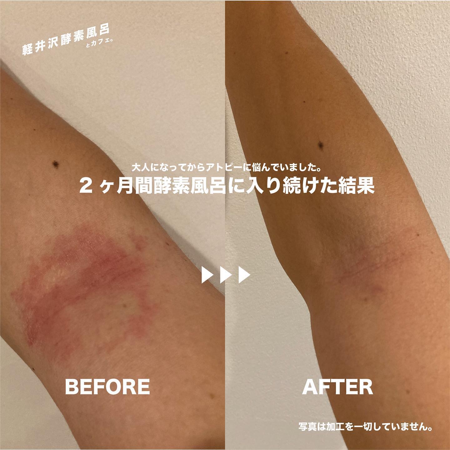 酵素 風呂 続け た 結果