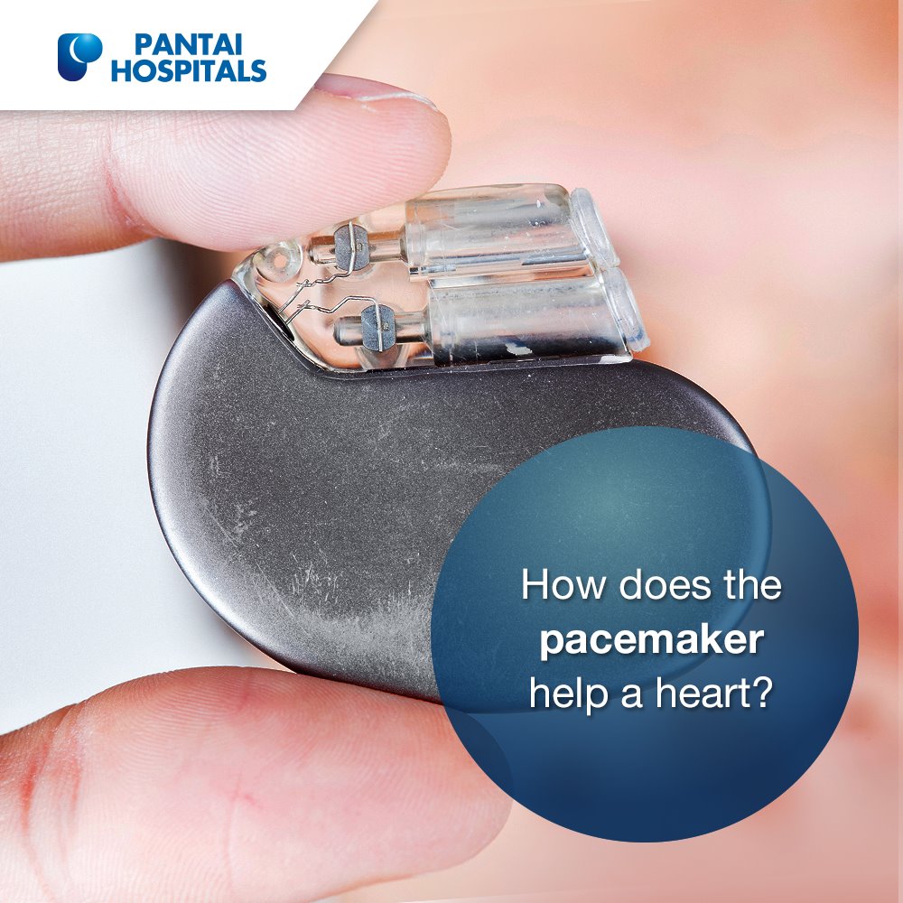 The pacemaker sends electrical... - Pantai Hospital Penang