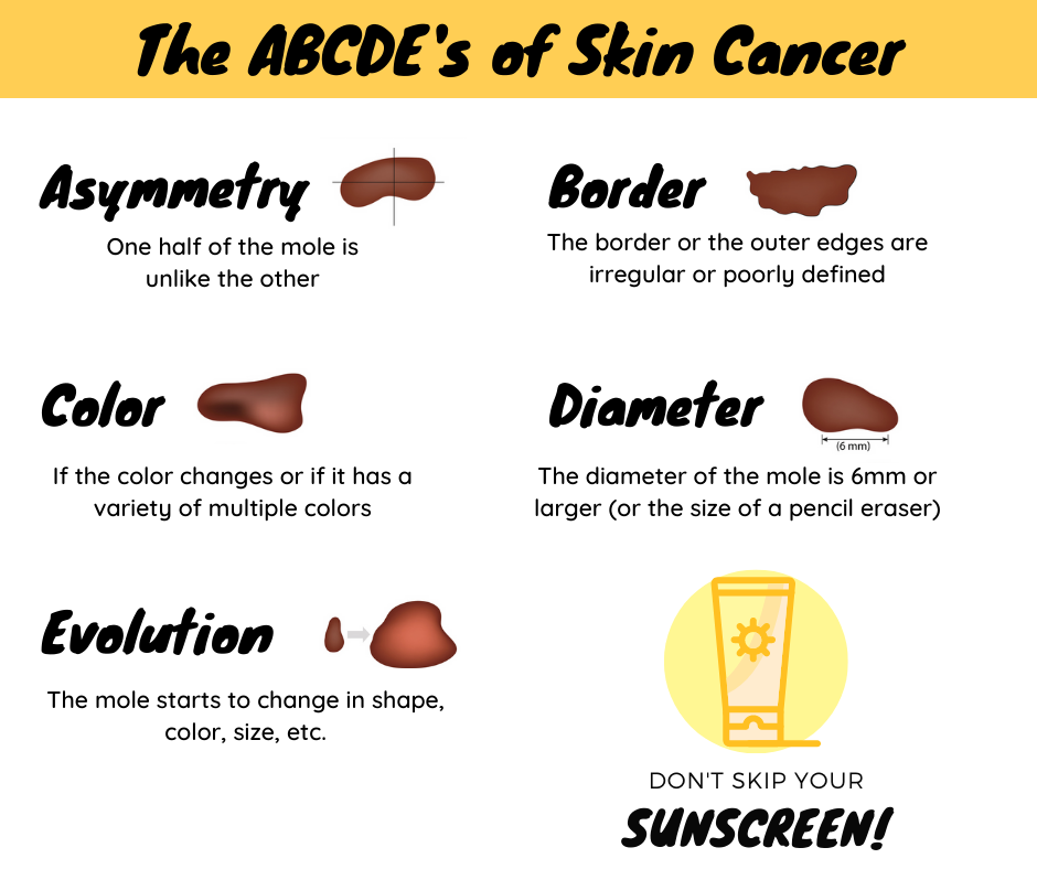 You know your ABC's, but do... - Anderson Bauman Chiropractic | Facebook
