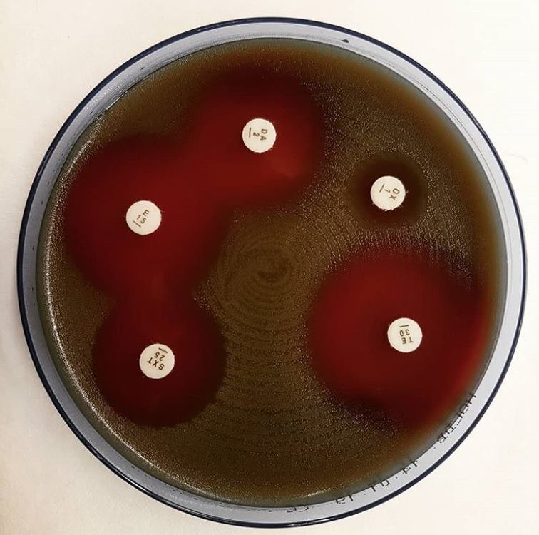 Microbe Notes - Streptococcus pneumoniae susceptibility... | Facebook