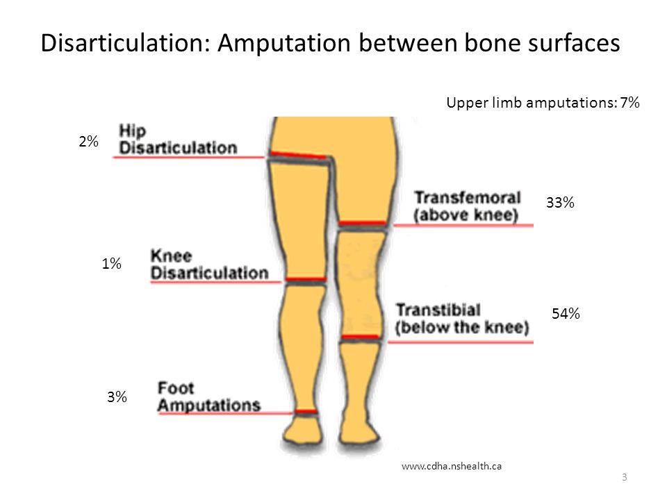 Physio Research - Risk Factors for Falls in People With a Lower Limb ...