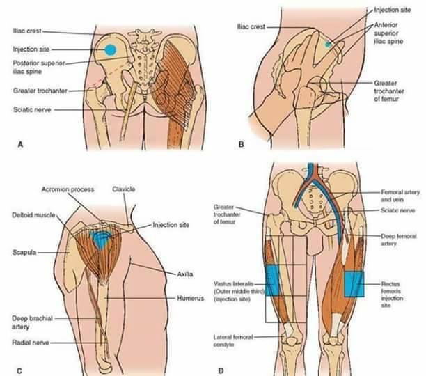 Common Sites for making various injection