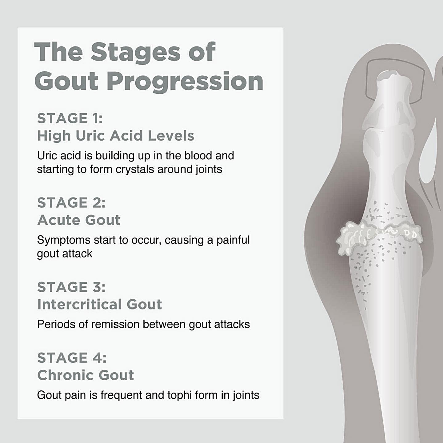 Gout is a type of inflammatory... - Assurance Healthcare Ltd.