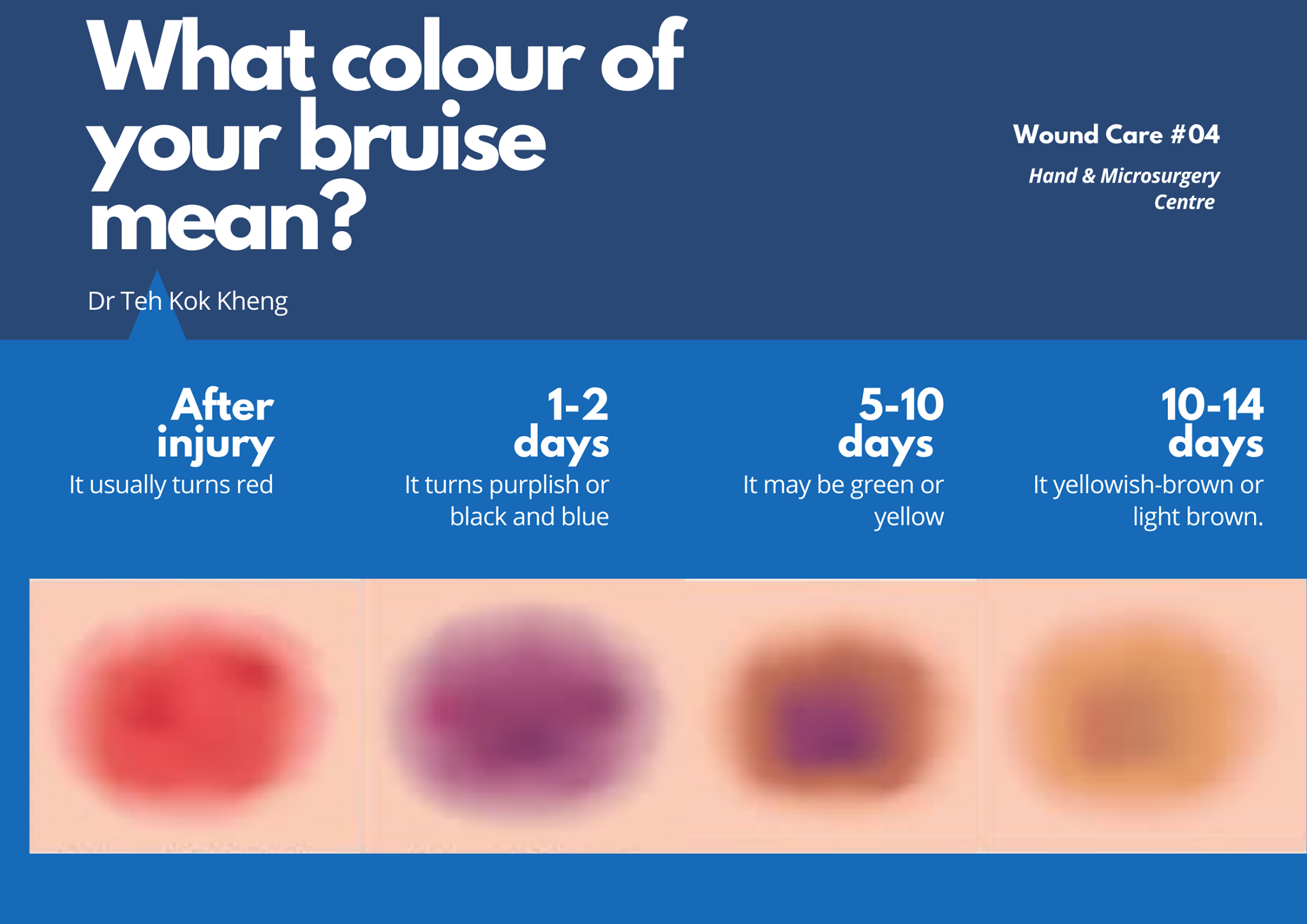 As you... - Hand & Microsurgery Clinic - Dr Teh Kok Kheng | Facebook
