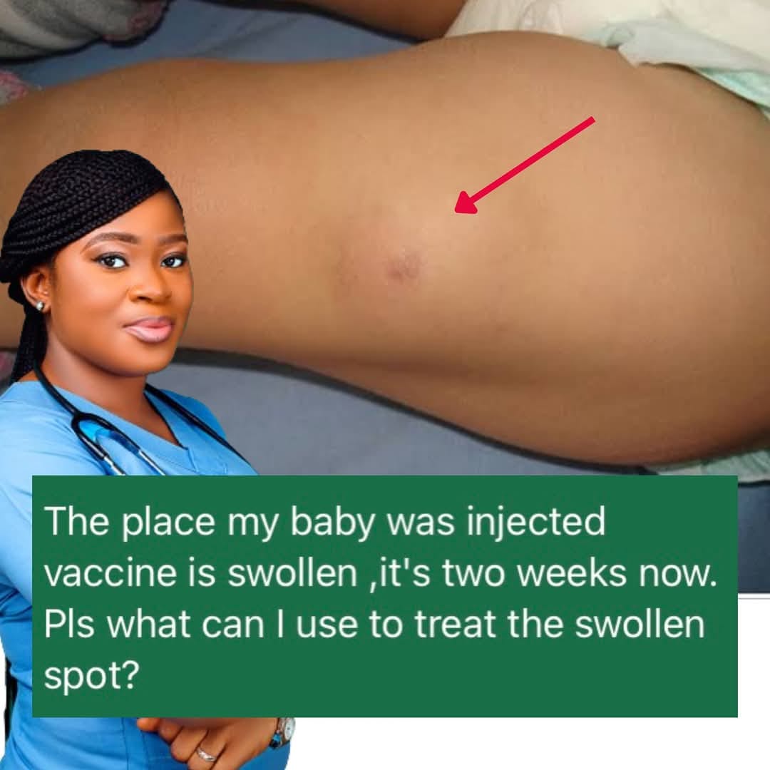 swelling after b12 injection What helps with swollen arm vaccine injection? Aod And 96046mg Injection Size:10x10ml 1000 mcg ml